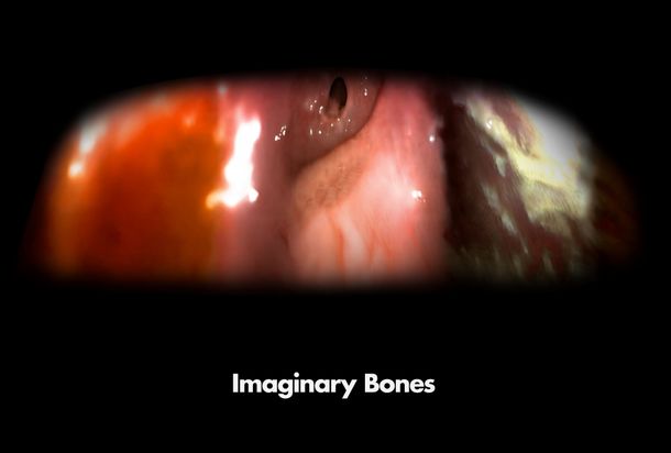 Imaginary Bones Imaginary Bones